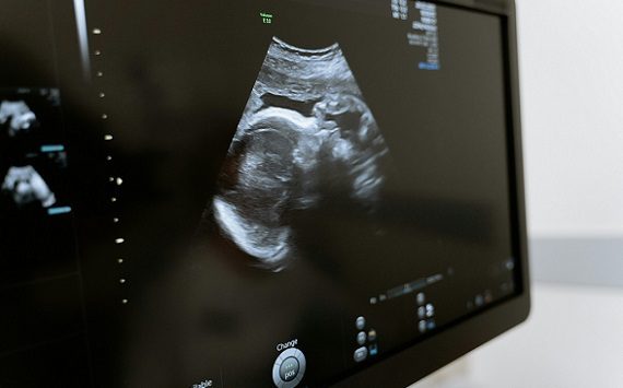 Un milione di euro per la Vita: un segnale di speranza!