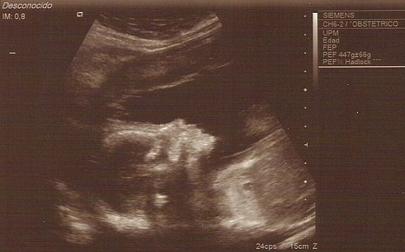 Un invito a firmare per la Vita