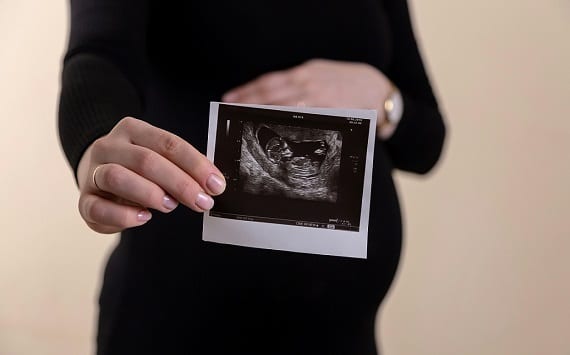 Hanno usato 56 milioni dei nostri soldi in un anno per uccidere bimbi in grembo!